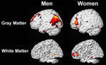 Brain men and women